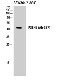 Presenilin 1 antibody