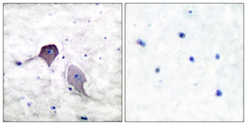 PS-1 antibody