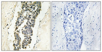 Presenilin 2 (phospho Ser330) rabbit pAb