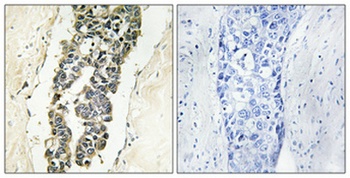 Presenilin 2 (phospho-Ser330) antibody