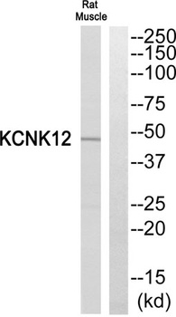 THIK-2 antibody