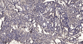 THIK-2 rabbit pAb Antibody