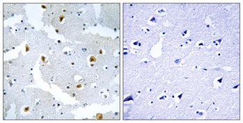 Formin 2 antibody