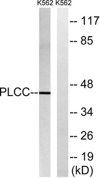 LPAAT-γ rabbit pAb Antibody
