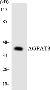 LPAAT-γ rabbit pAb Antibody