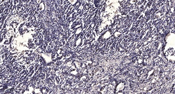 LPAAT-γ rabbit pAb Antibody