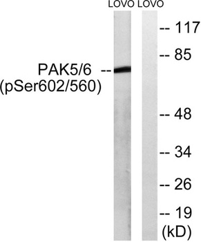 PAK5/6 (phospho-Ser602/S560) antibody