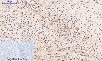 PTEN (phospho-Ser380/T382/T383) antibody