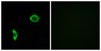 IP Receptor antibody