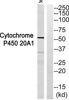 CYP20A1 rabbit pAb Antibody