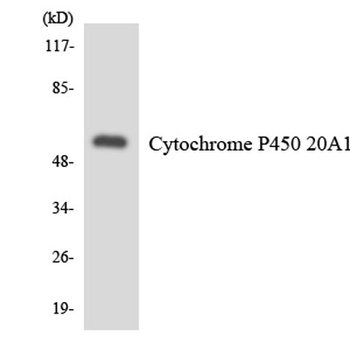 CYP20A1 rabbit pAb Antibody
