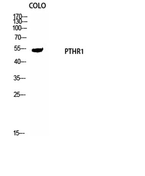 PTH antibody