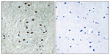 REXO1 antibody