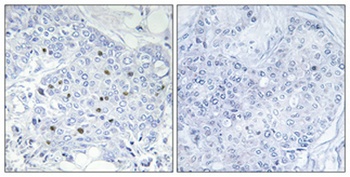 BAF250b rabbit pAb Antibody