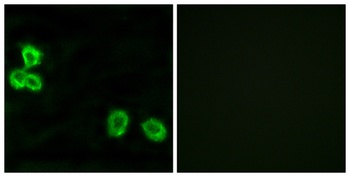 BAI-1 antibody