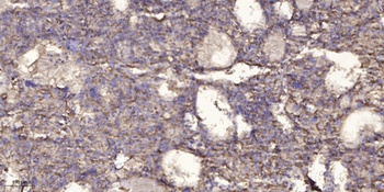 INTS2 rabbit pAb Antibody