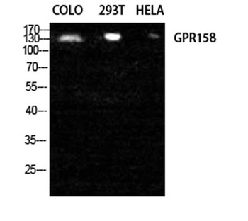 GPR158 rabbit pAb