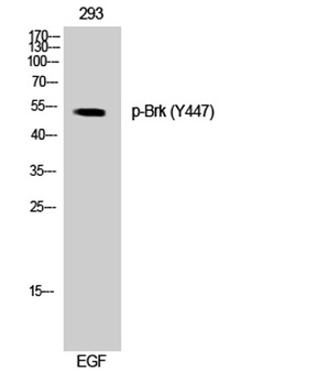 Brk (phospho-Tyr447) antibody