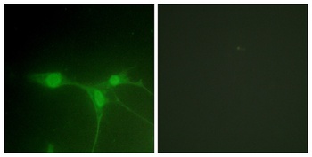 Brk rabbit pAb Antibody