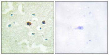 PTP1B (phospho Ser50) rabbit pAb Antibody