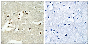 NCoA-5 rabbit pAb