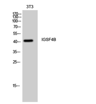IGSF4B antibody
