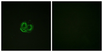 Actin-alpha/gamma antibody