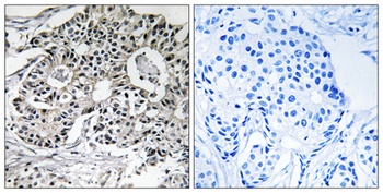 Pxmp2 antibody