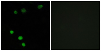 TP53INP2 rabbit pAb