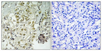 Rad51D antibody