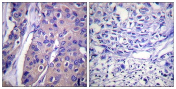 Raf-1 (phospho Ser296) rabbit pAb Antibody