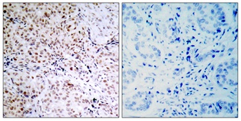 Rb (phospho-Ser795) antibody