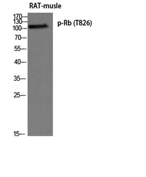 Rb (phospho-Thr826) antibody