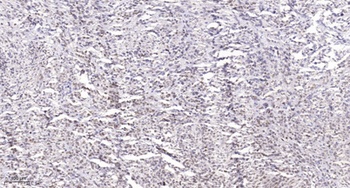 Rb (phospho-Ser788) antibody