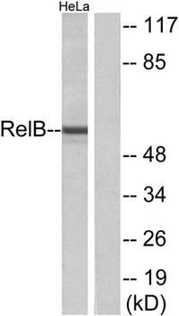 RelB rabbit pAb Antibody