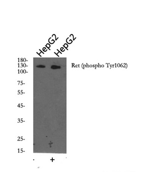 Ret (phospho Tyr1062) rabbit pAb