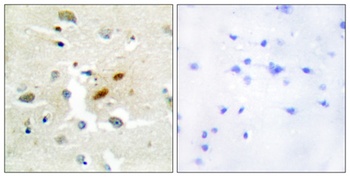 DNA pol ζ rabbit pAb