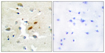 DNA pol zeta antibody