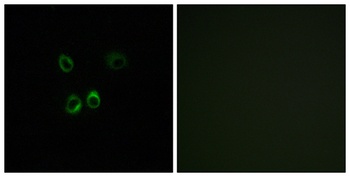 RGR antibody