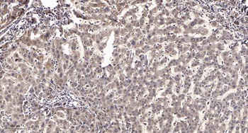 RGS12 antibody