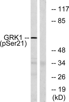 GRK 1 (phospho Ser21) rabbit pAb