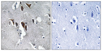 ELOVL5 rabbit pAb