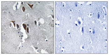 ELOVL5 antibody