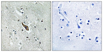 Robo2 antibody