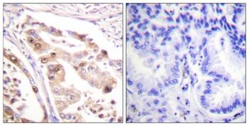 RPA32 rabbit pAb Antibody