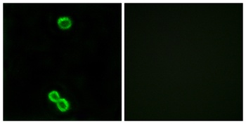 Ribosomal Protein L3L antibody