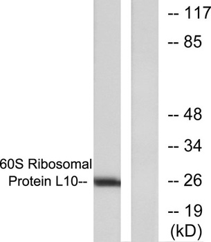 QM rabbit pAb Antibody