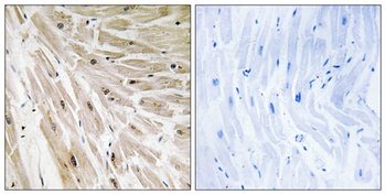 Ribosomal Protein L22 antibody