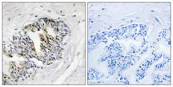Ribosomal Protein LP2 rabbit pAb