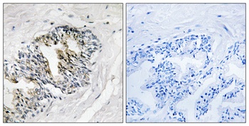 Ribosomal Protein LP2 antibody